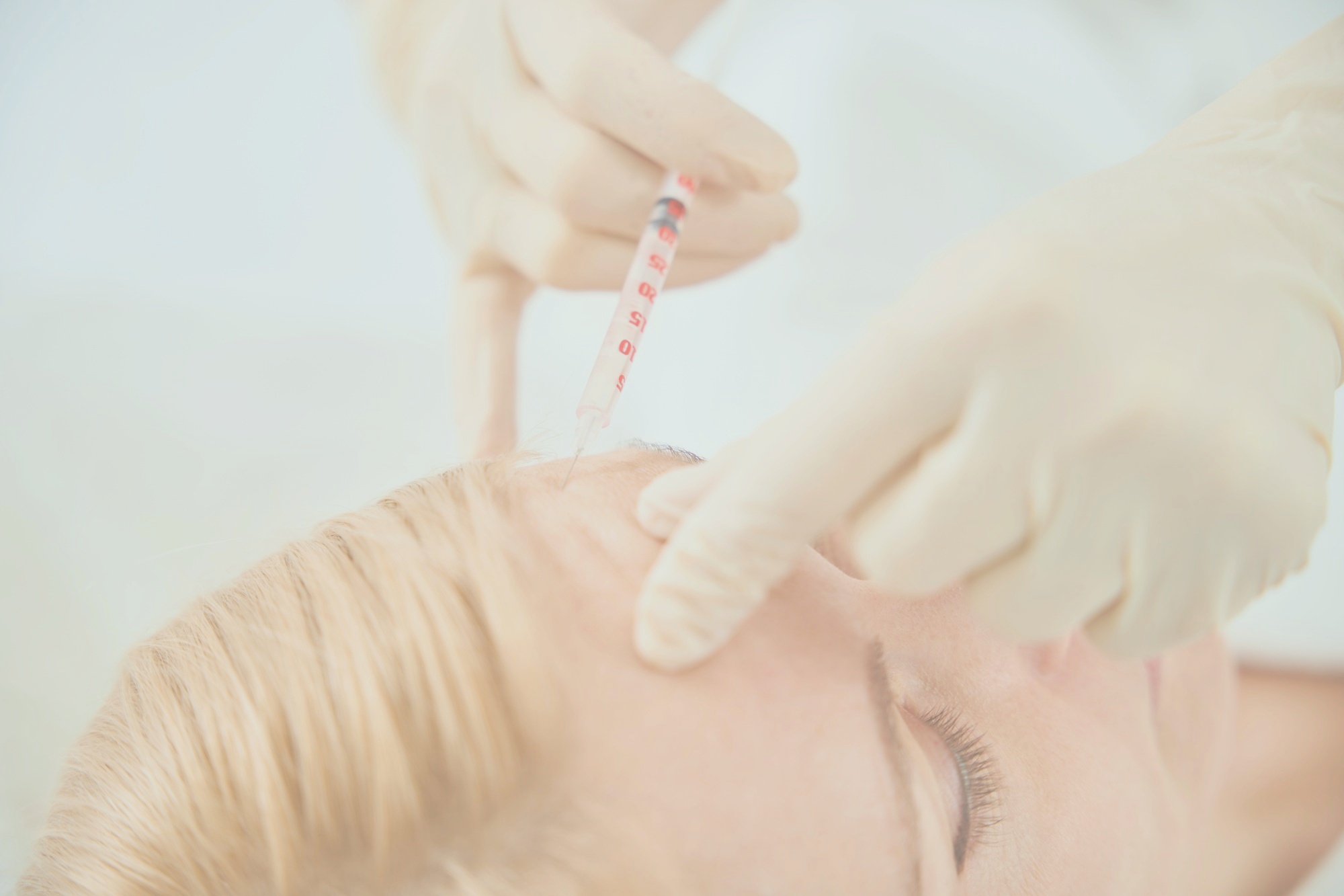 Botox and the Evolution of Preventative Aesthetics: A Forward-Looking Approach